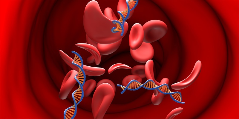 Hipertensión arterial: causas, síntomas y prevención