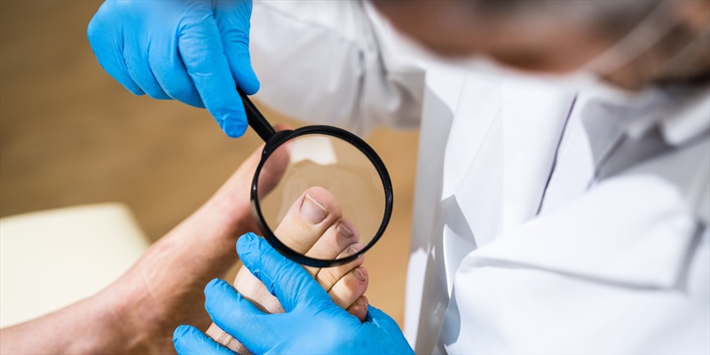 Uñas encarnadas: prevención y tratamiento