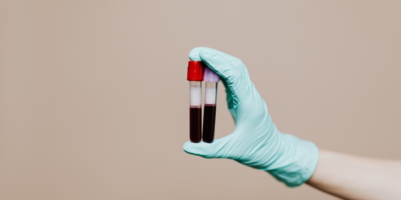 Ayuno para análisis de sangre, ¿por qué es necesario?